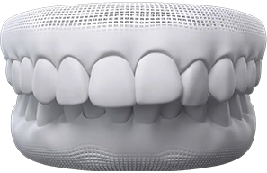 Overbite Overbite