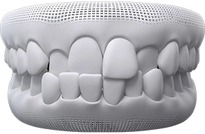 Crossbite Crossbite